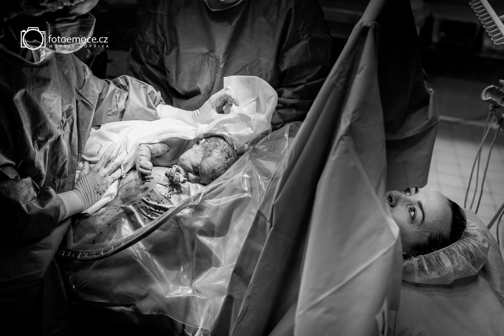 Vašík - císařský řez